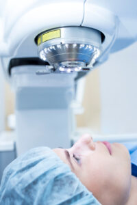A patient under a LASIK laser